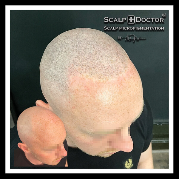 Scalp Doctor