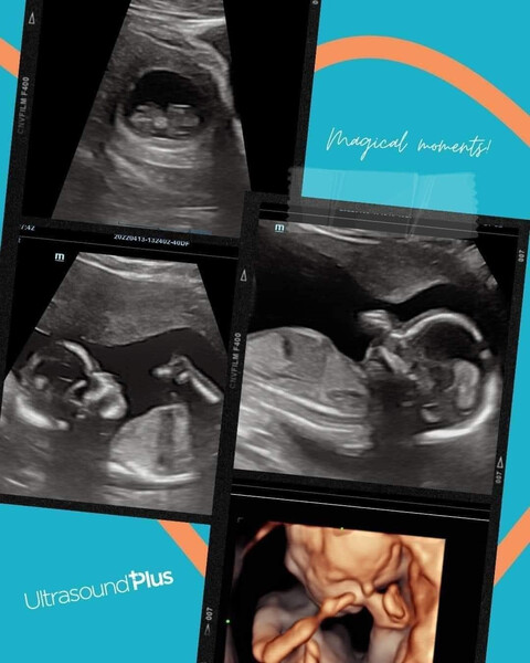 Ultrasound Plus Limited
